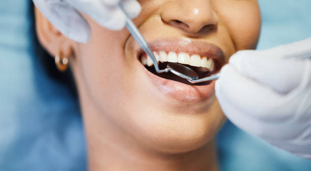 Best Emergency Care for Gum Disease in Shepherd, MI