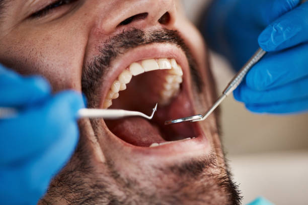 Best Walk-In Emergency Dental Services in Shepherd, MI