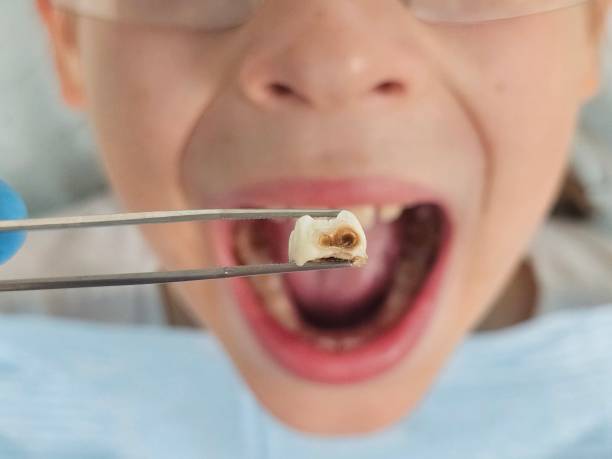 Best Emergency Pediatric Dental Care in Shepherd, MI