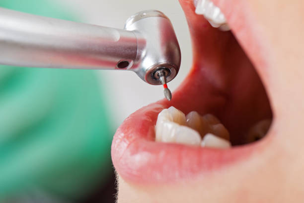 Best Emergency Care for Gum Disease in Shepherd, MI